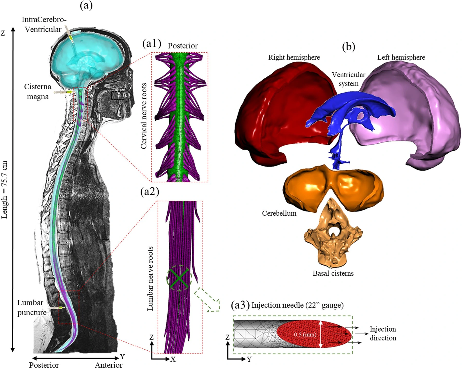 MRI-based human anatomy and spinal nerve roots — Fig. 1 from the published PDF